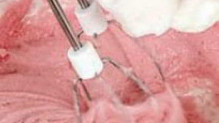 Рецепт мусса клюквенного из манной крупы