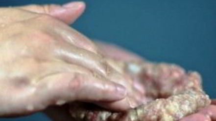 Рецепт котлет, фаршированных грибами