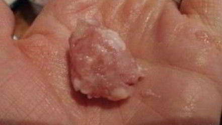 Рецепт супа с куриными фрикадельками и овощами