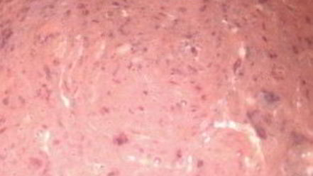 Рецепт печеночных оладий на сметане