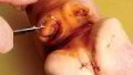 Рецепт холодца гояжьей рульки и копыта