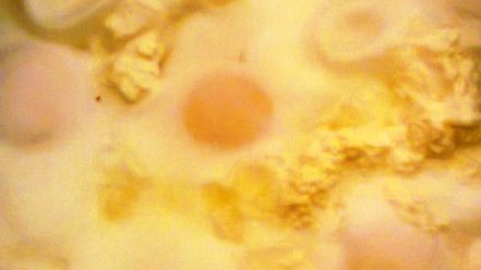 Рецепт глазуньи с творогом